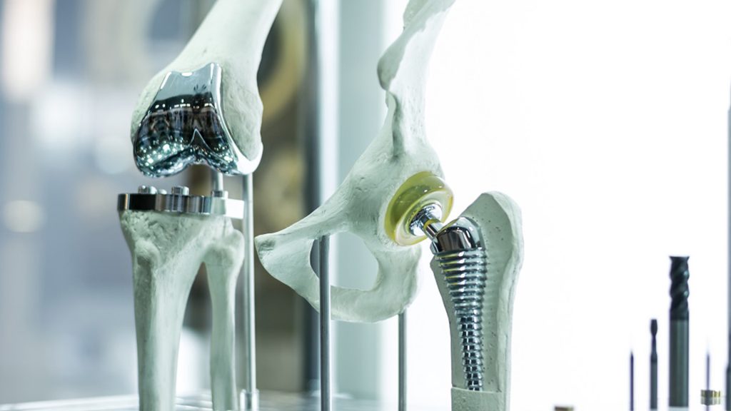 Notre approche est basée sur la mise en œuvre de technologies de pointe, telles que le nettoyage par ultrasons, pour le nettoyage de pièces médicales